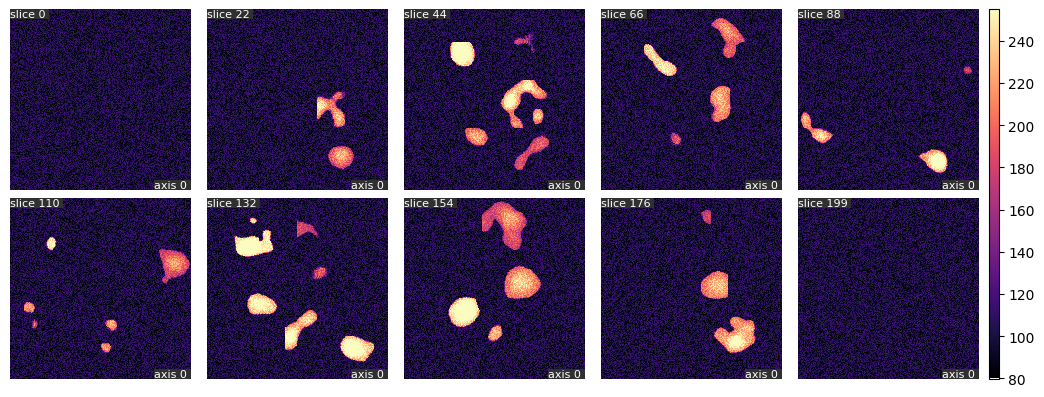 synthetic_noisy_collection_slices