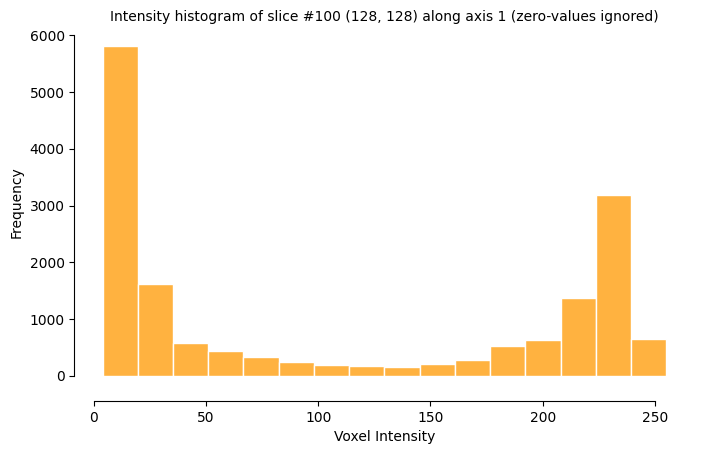 viz histogram