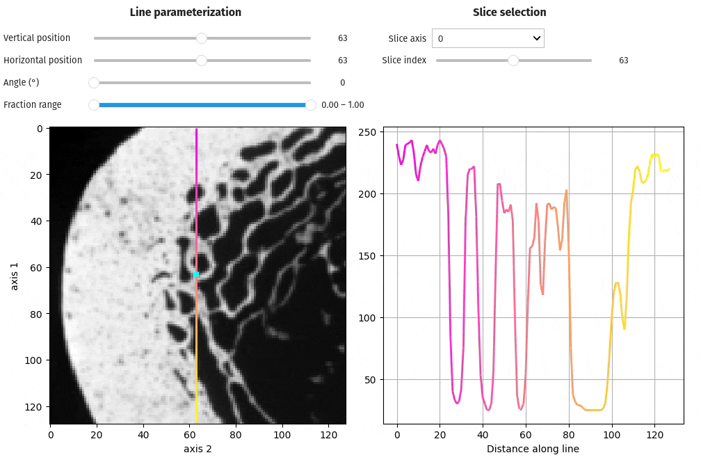 viz histogram
